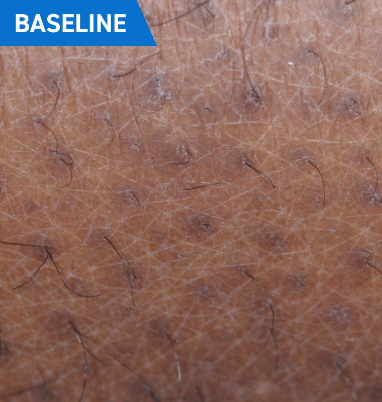 baseline2x