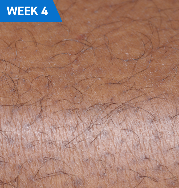 week42x