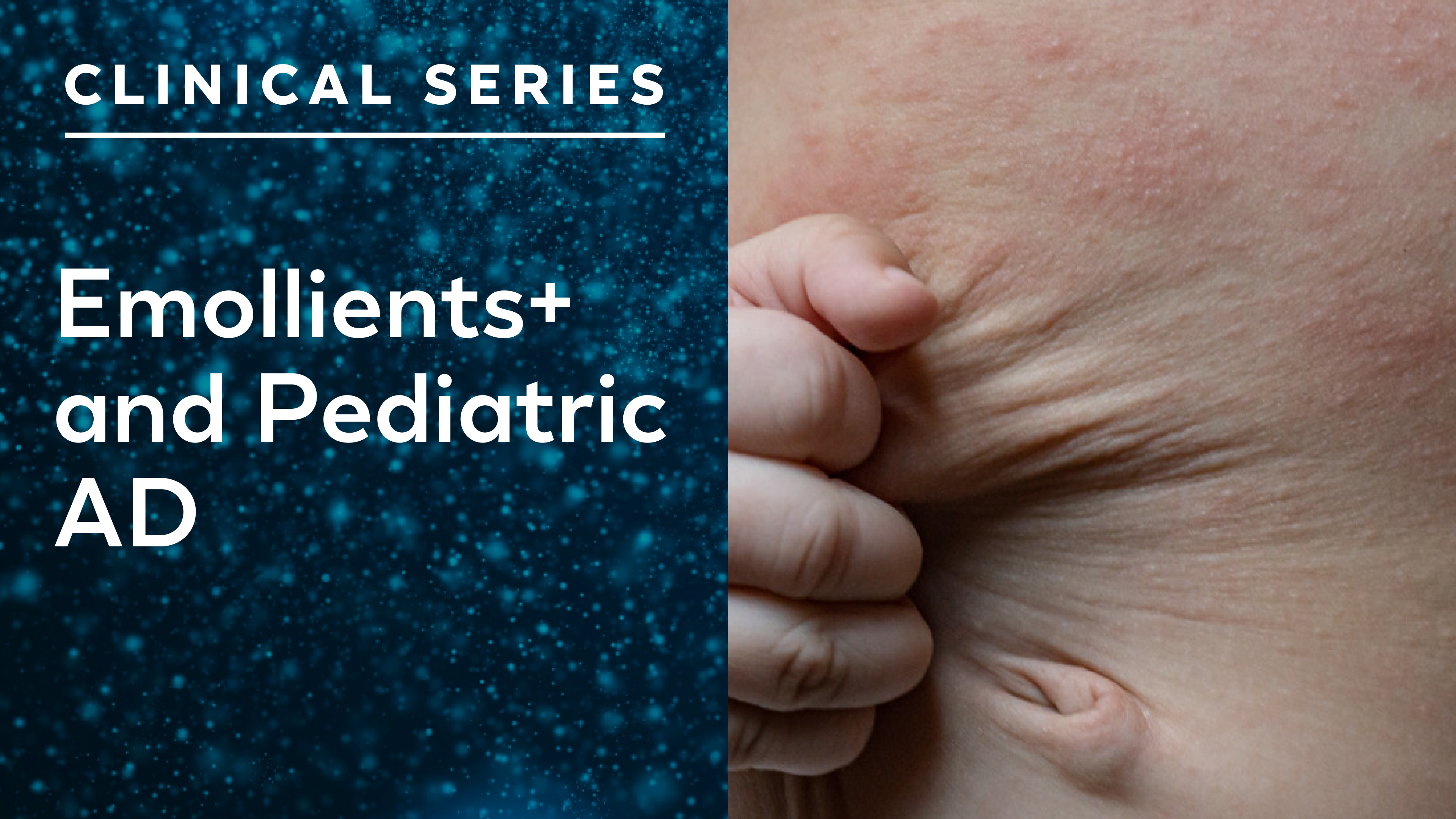 Clinical Series-Article